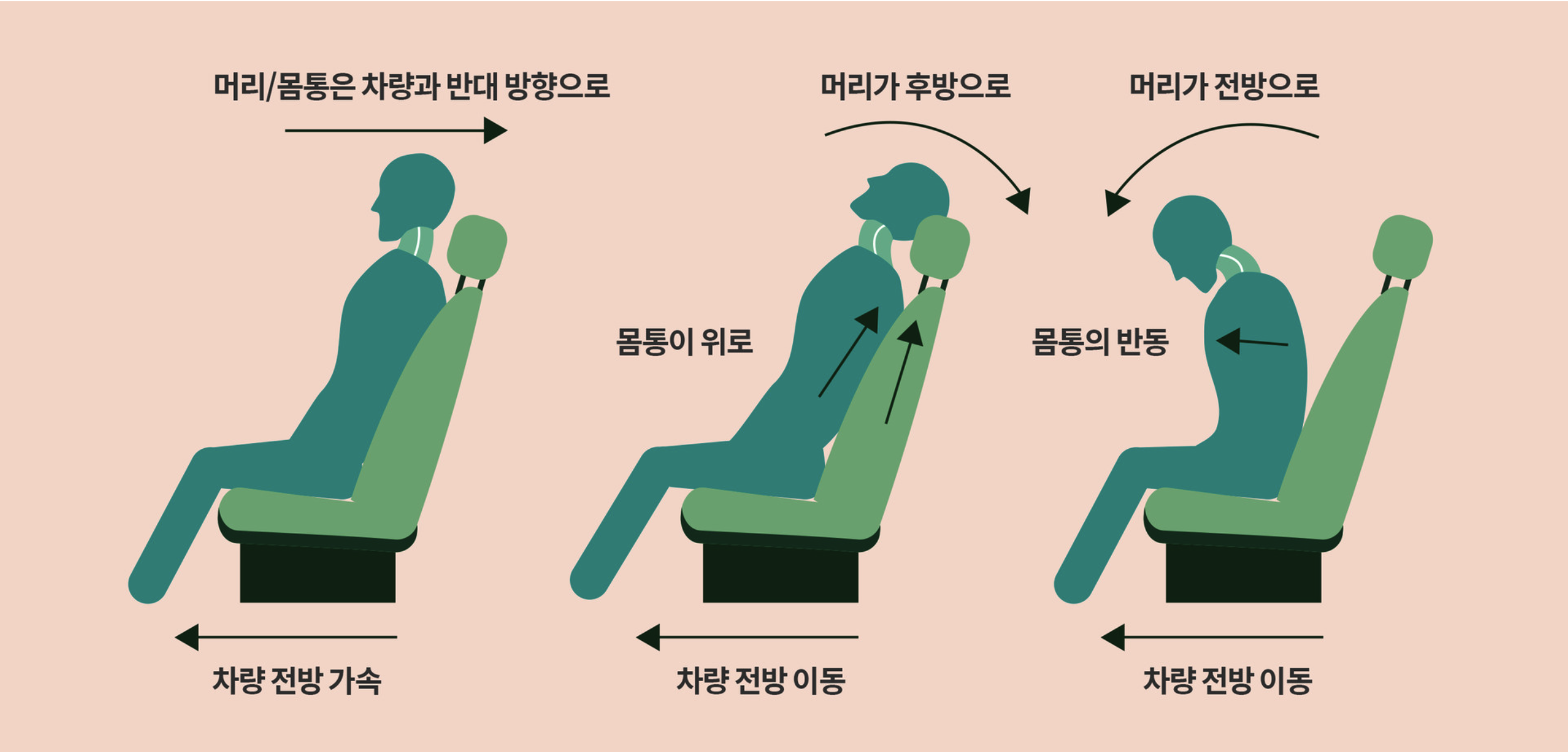 편타성 손상 - 교통사고 시 목이 채찍처럼 움직이며 경추에 손상이 발생하는 과정