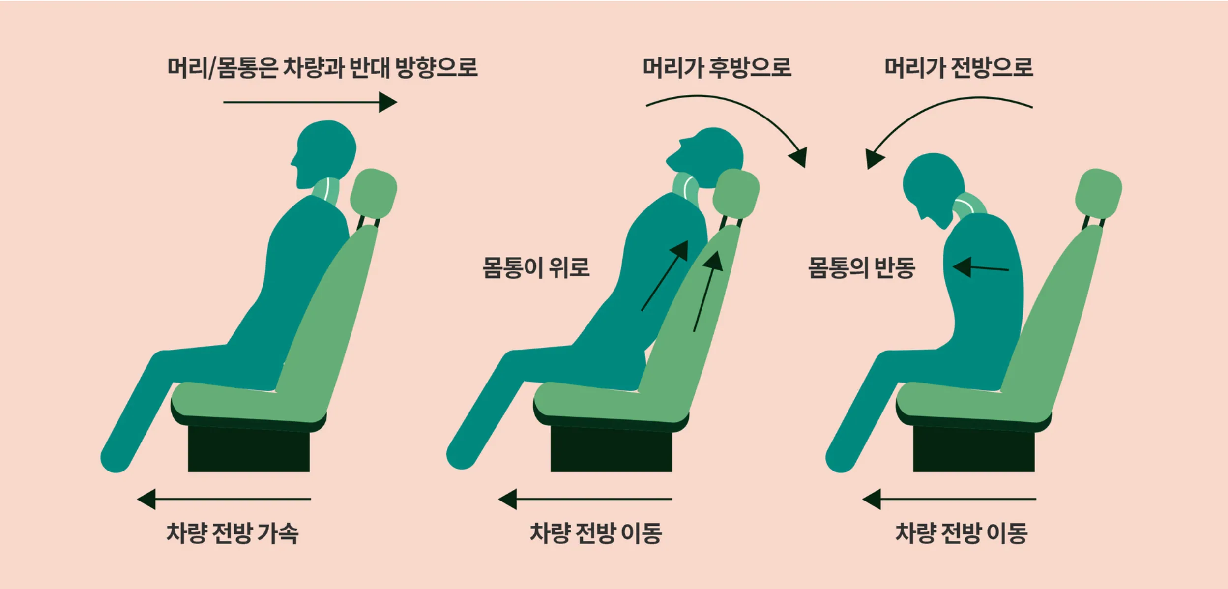 편타성 손상 - 교통사고 시 목이 채찍처럼 움직이며 경추에 손상이 발생하는 과정
